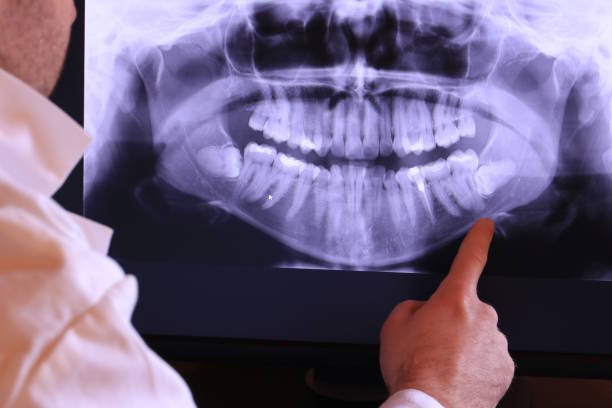 Best Emergency Dental Services for Seniors in Spring Grove, IL